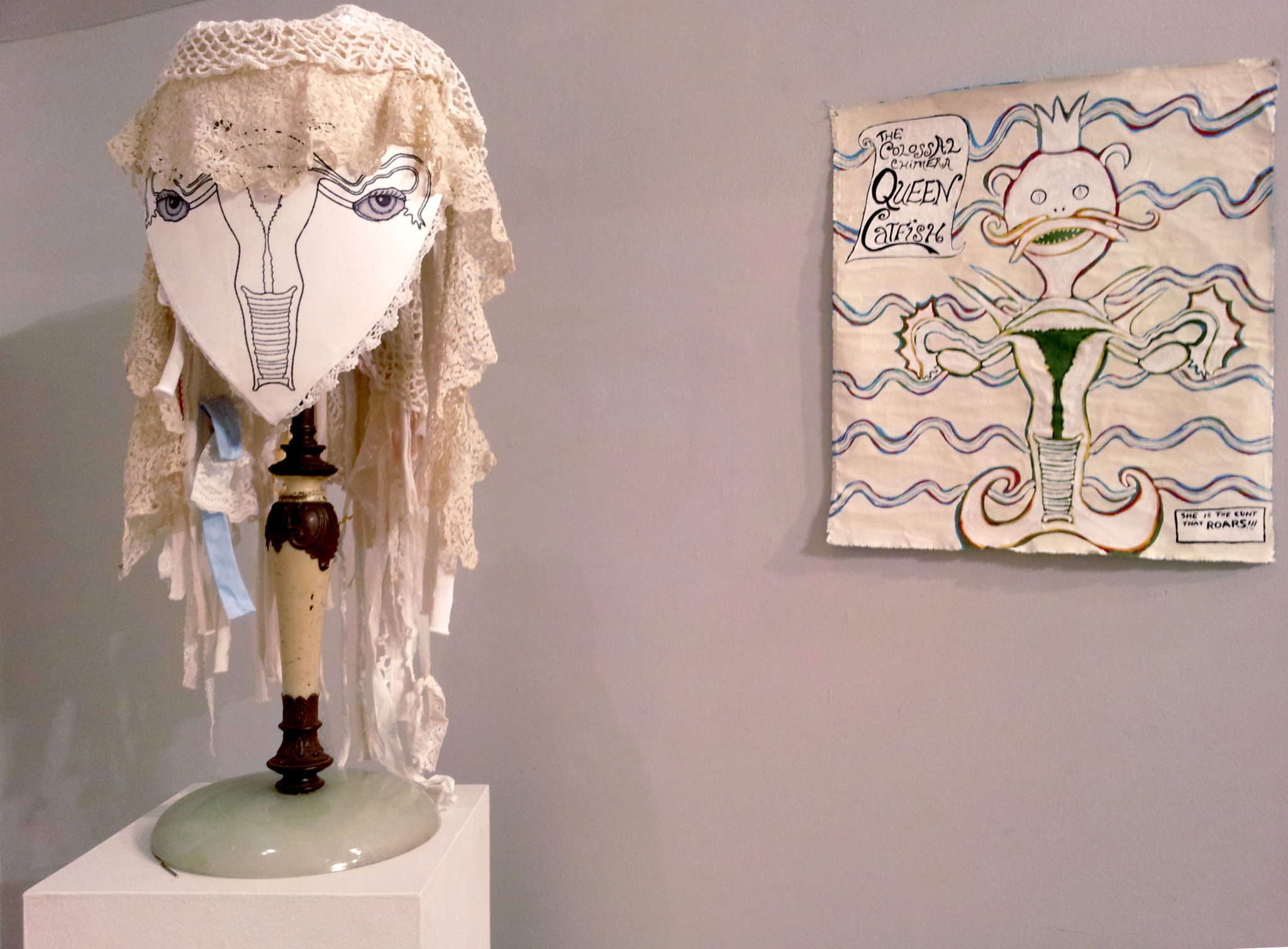Exquisite Uterus Project