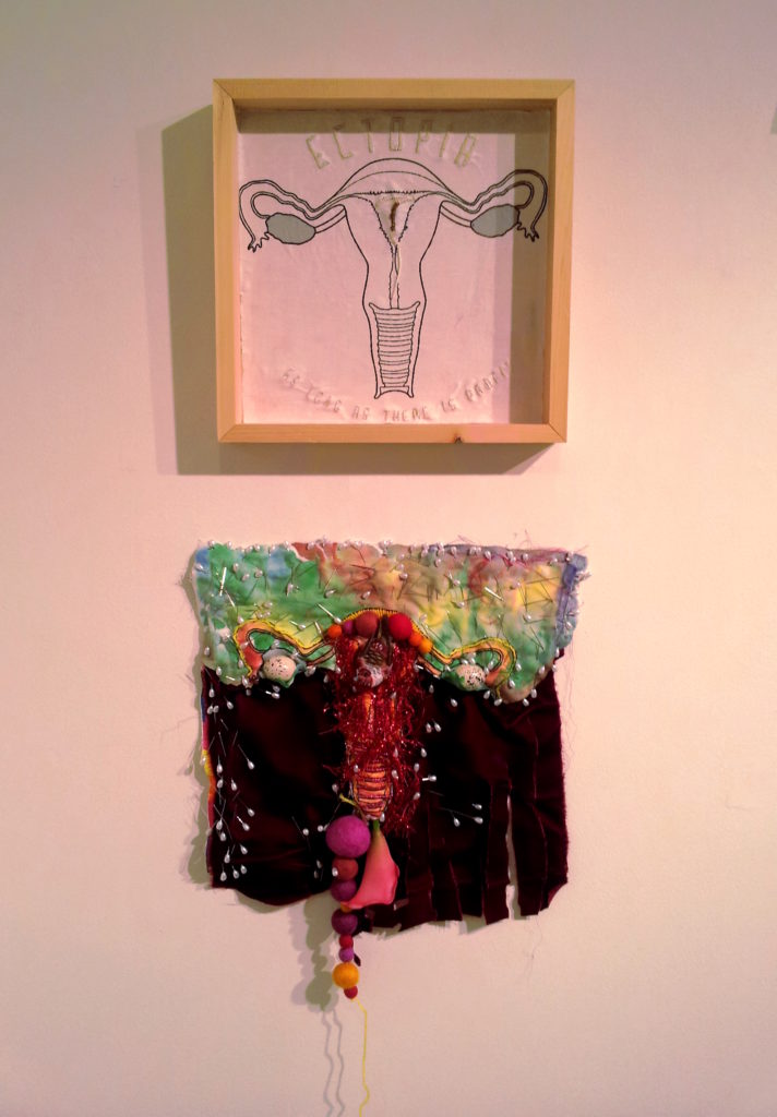 Exquisite Uterus Project Pieces - Image 3