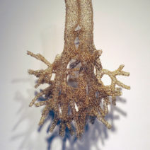 Anne Mondro