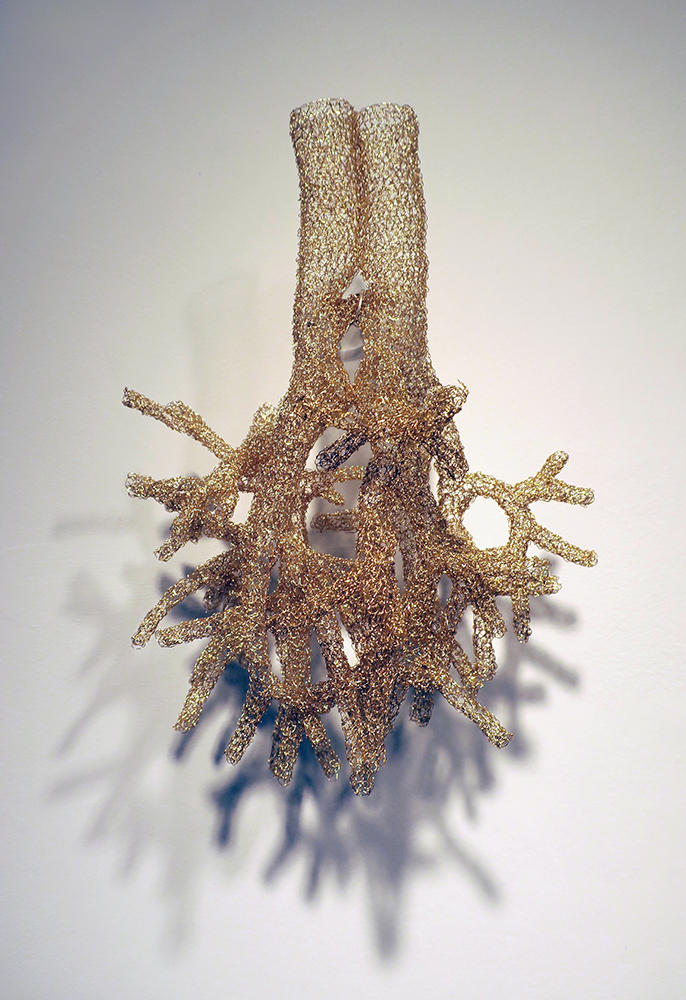 Anne Mondro